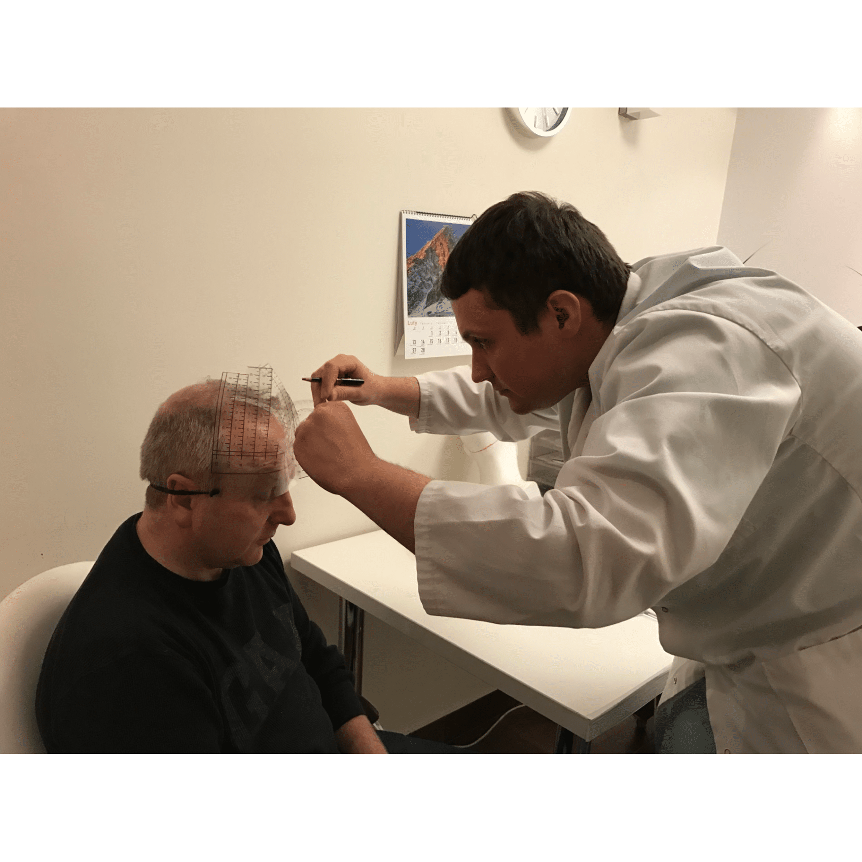 BannerImage_Eamon’s Hair Transplant Journey - Part III: After Treatment