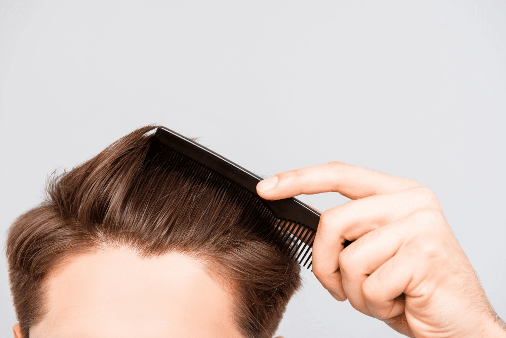 Image2_7 Questions Answered to Get You Ready for Hair Transplant Surgery Abroad